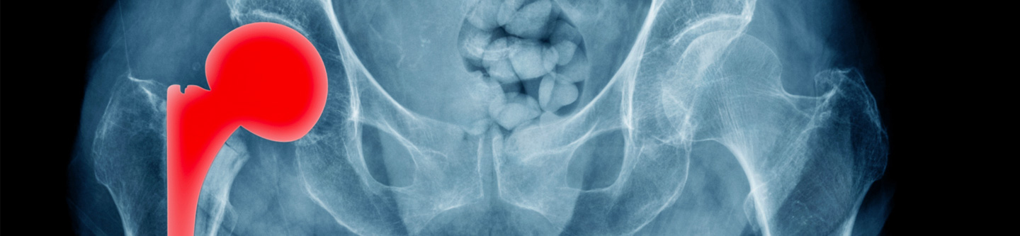 Close up of X-ray.